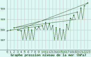 Courbe de la pression atmosphrique pour Guernesey (UK)