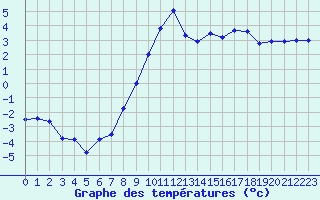 Courbe de tempratures pour Strasbourg (67)