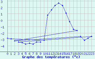 Courbe de tempratures pour Ble / Mulhouse (68)