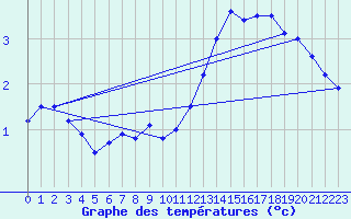Courbe de tempratures pour Tracardie