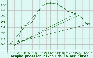 Courbe de la pression atmosphrique pour Douzens (11)