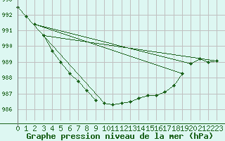 Courbe de la pression atmosphrique pour Trgueux (22)